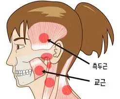 어금니 꽉 깨물고 귀 통증? 예방 생활 습관
