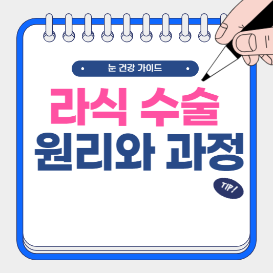 라식 수술 원리와 과정