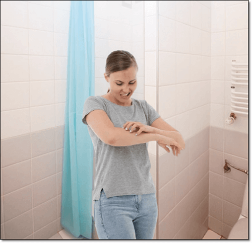 피부가려움증 여자