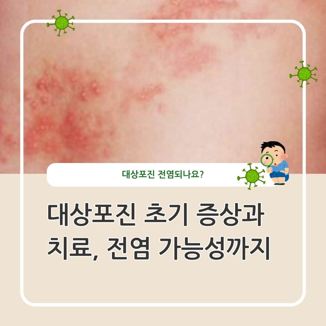 대상포진 초기 증상과 치료
