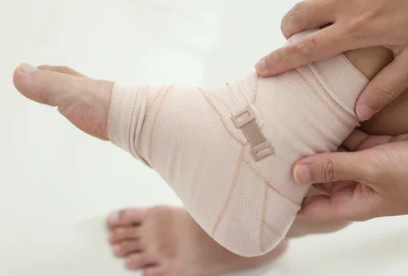 발목 염좌 병원 치료