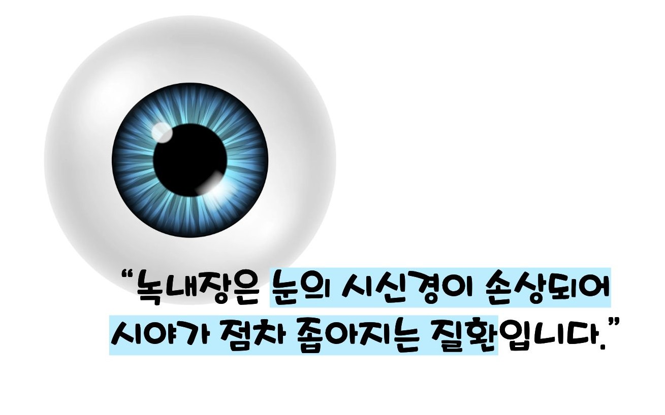 녹내장 초기증상