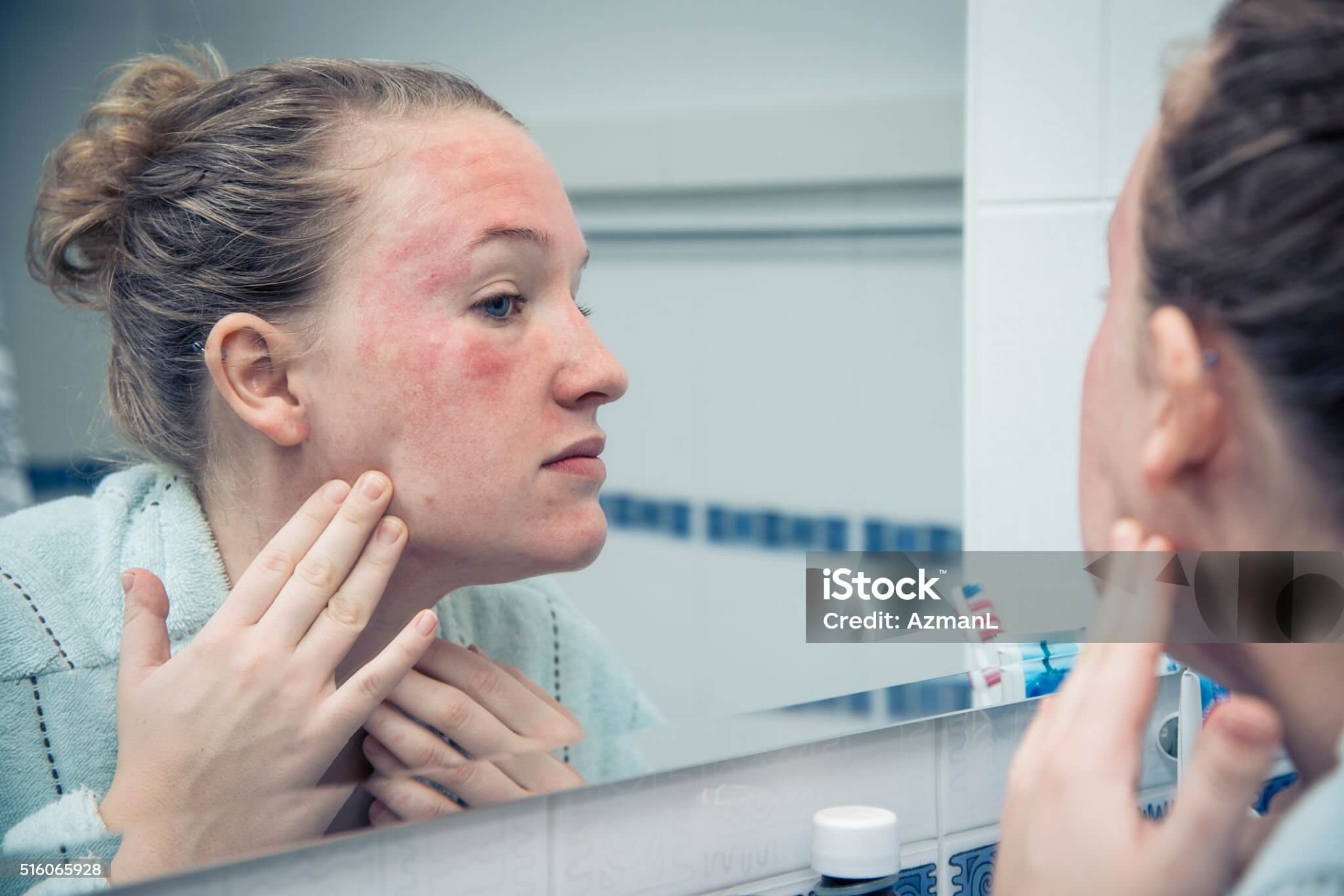 피부 트러블 응급처치 방법 &ndash; 전문가가 알려드리는 즉각 대처법