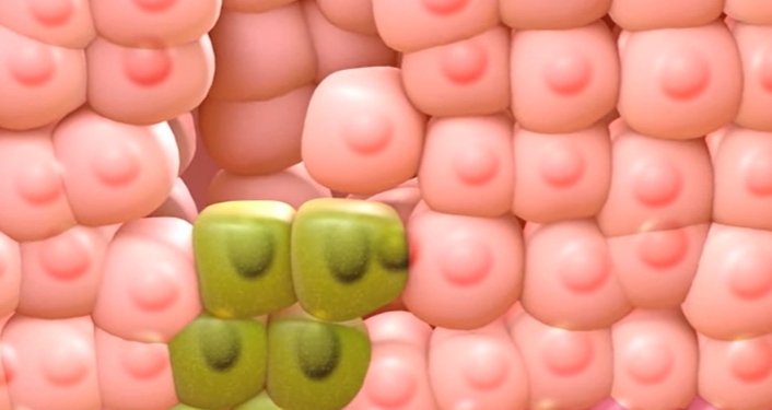 hpv 바이러스 증상