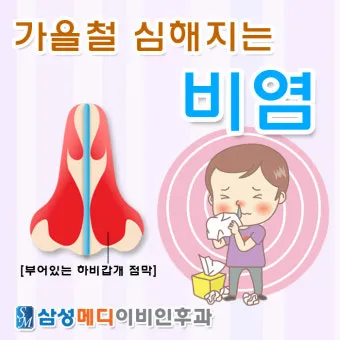 환절기 비염 관리 실내 가습 환풍기 청소 생활법_24