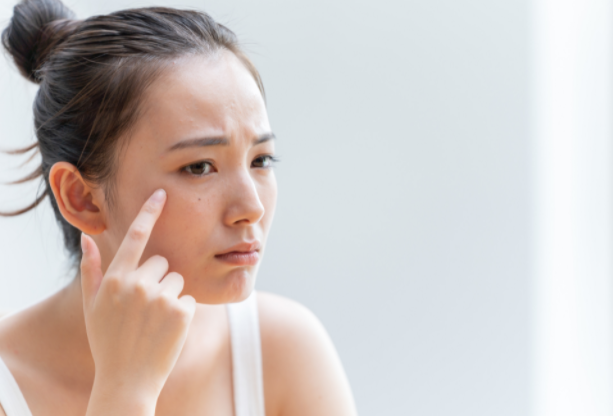 눈꼬리 주름을 걱정하는 여성