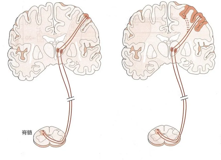 귀에서-나는-심장-소리!-박동성-이명-증상과-원인-똑똑한-이명-치료법-알아보기