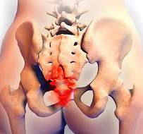 꼬리뼈가 아픈 이유