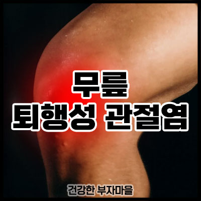 무릎 퇴행성 관절염