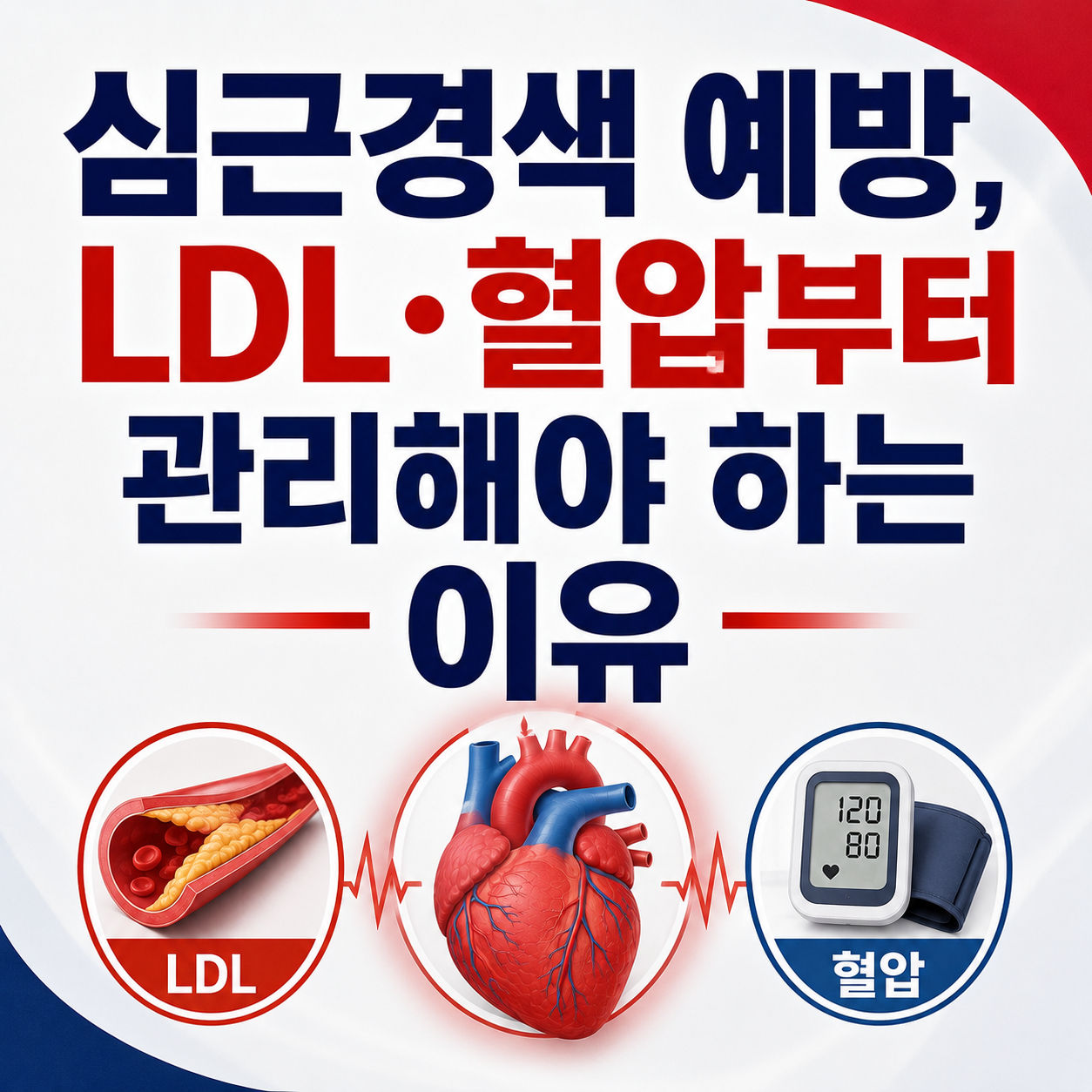 심근경색 예방