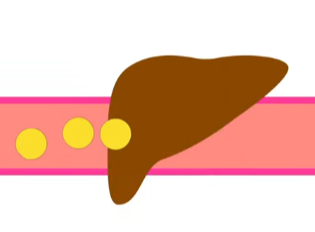 인슐린저항성