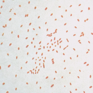 백일해 관련주 대장주 테마주 수혜주 TOP5