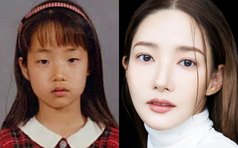 박민영 어렸을 적 모습