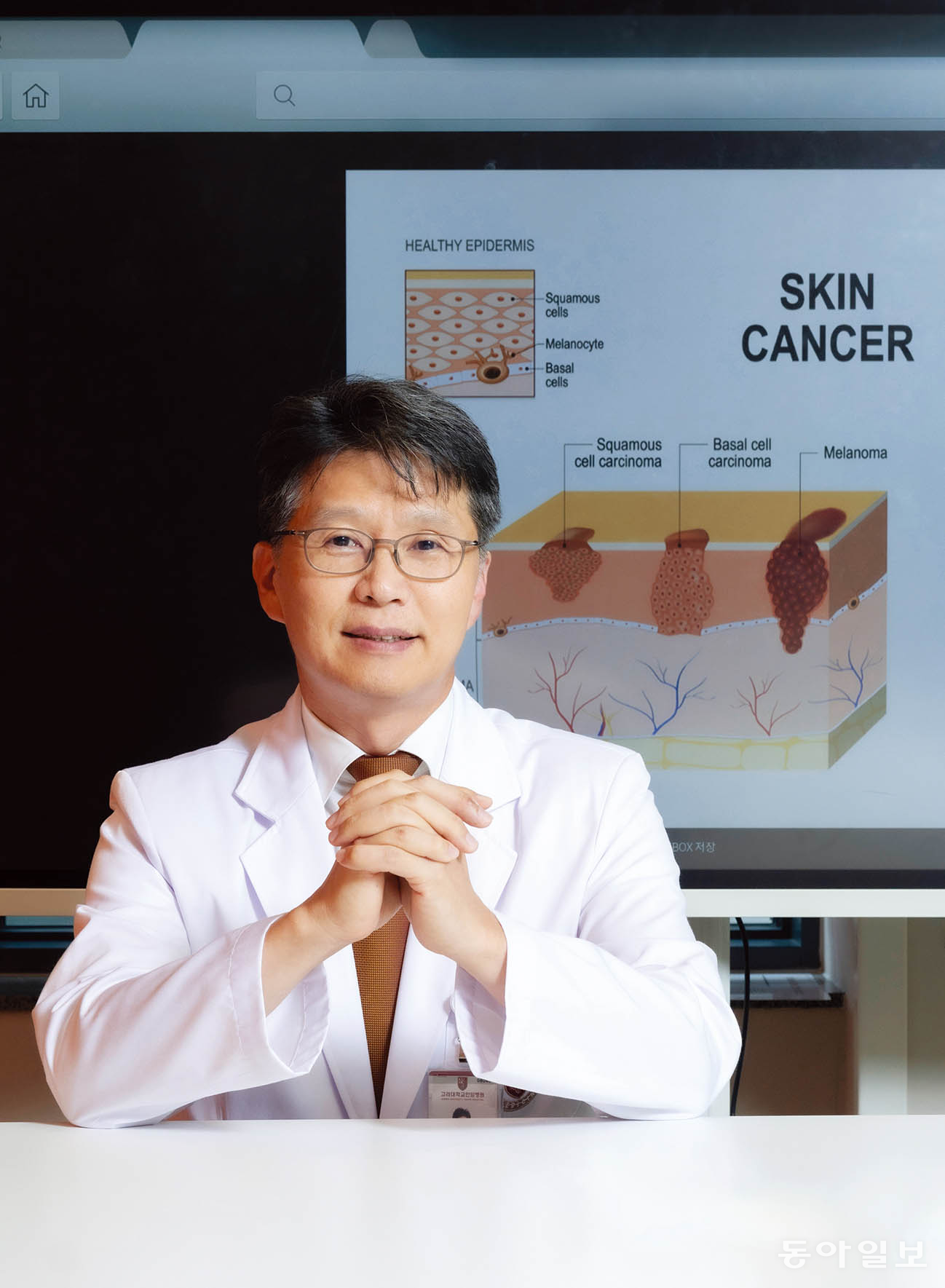 피부암(피부흑색종) 조기 발견&middot;증상&middot;예방 가이드 관련 이미지