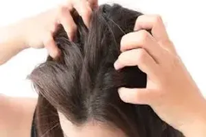 가려움