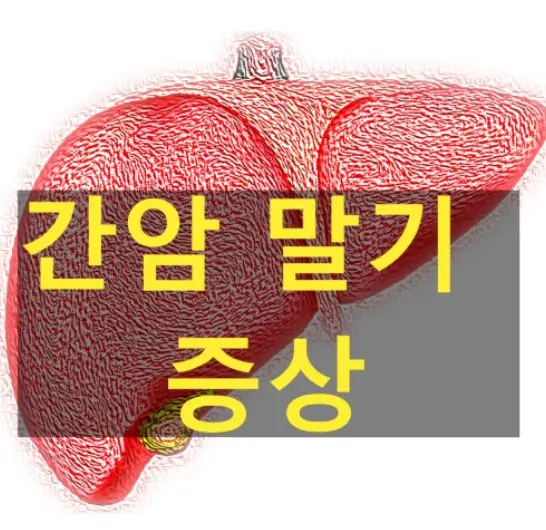 간암 말기증상