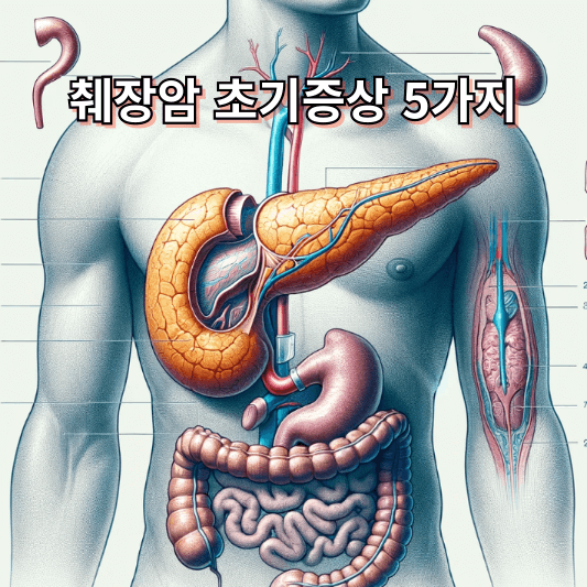 췌장암 초기증상