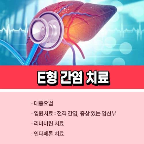 E형_간염_치료
