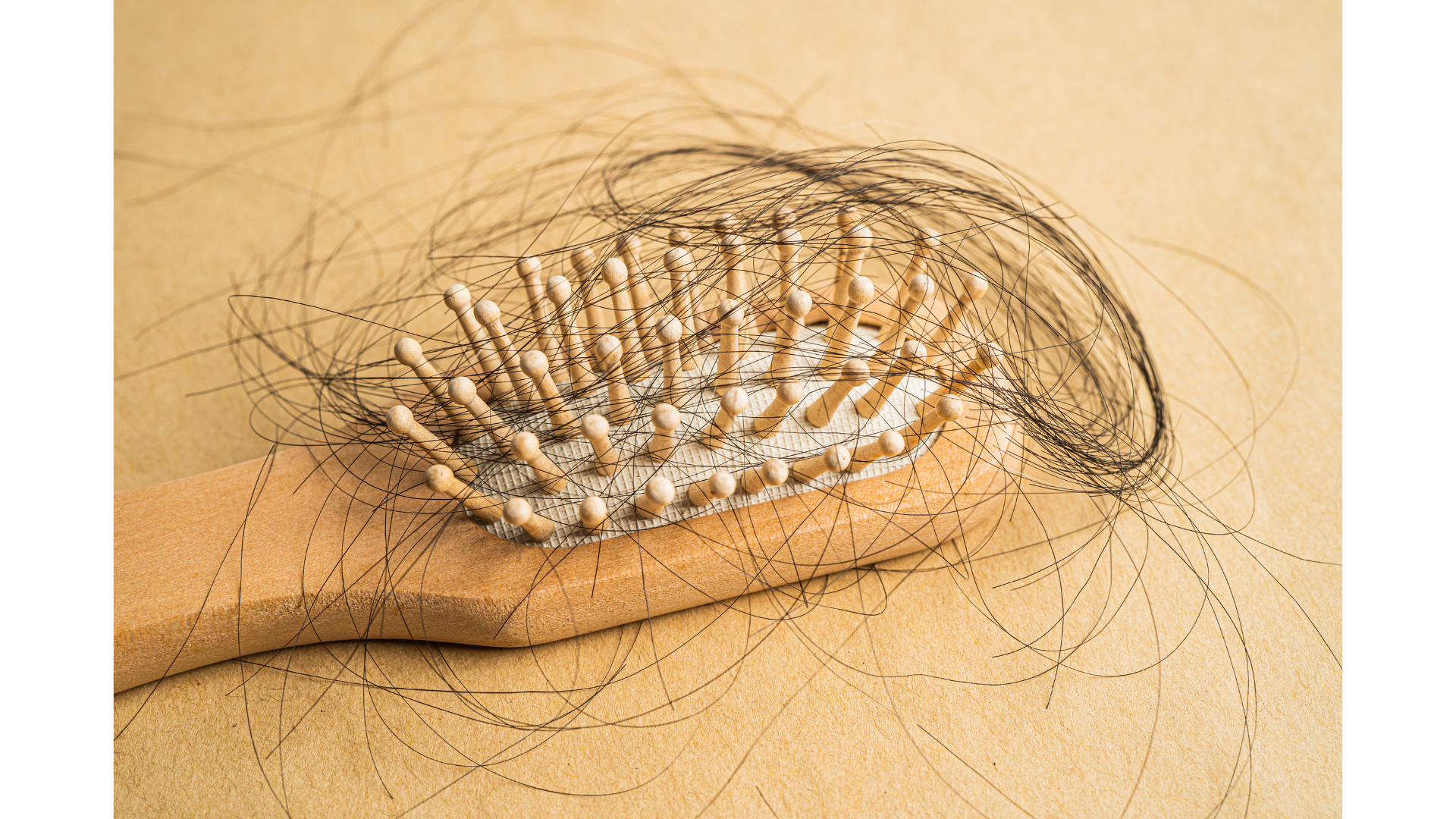 탈모와 관련된 사진