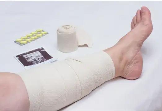 하지정맥류 초기 증상과 원인 치료방법