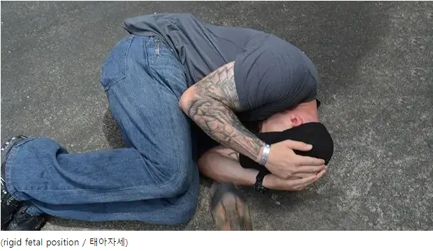압사 사고 대비 태아 자세