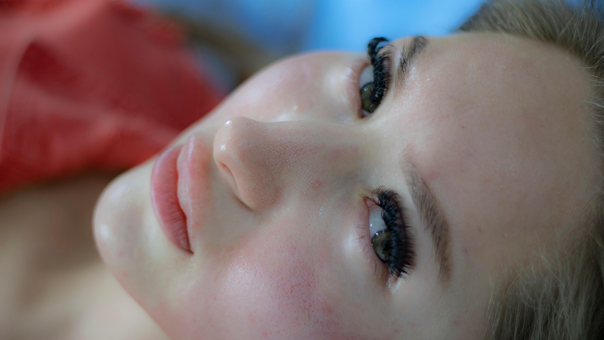 속여드름과 치료방법