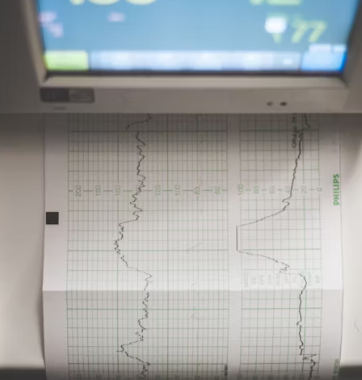 갑상선 기능 항진증 증상 원인 예방 가이드