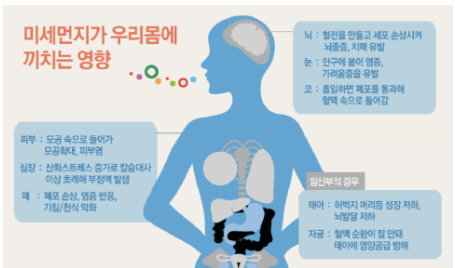 초미세먼지와 루이소체 치매 연구 결과 관련 이미지