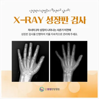 성장판 닫혀도 키 클 수 있는 방법과 성장 호르몬 시기_21