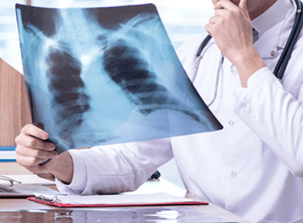 폐질환, 조기 발견과 관리가 중요한 이유