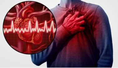 심장의 이상증상 이미지