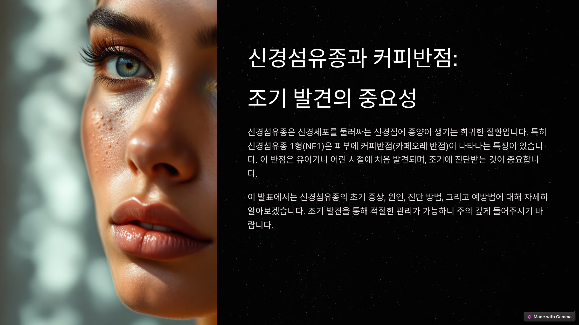 신경섬유종 커피반점 초기에 잡아야 한다! 초기 증상과 예방법