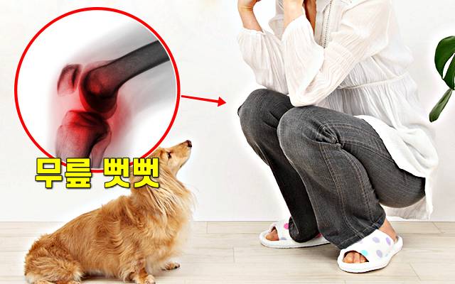 무릎 아플때 가는 병원 의사쌤,무릎에 안좋은 쪼그려 앉기