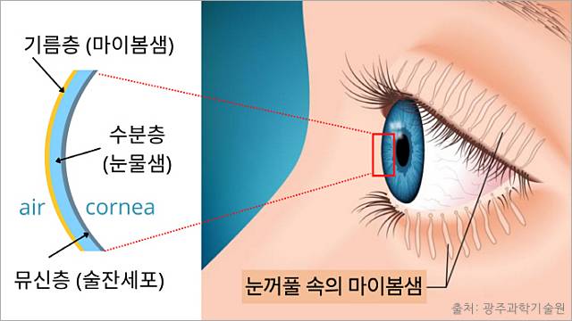 눈 따갑고 눈물 안구건조증 해결 눈뻑뻑함 이물감 눈건조증 원인