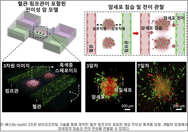 POSTECH&middot;부산대, 3D 바이오프린팅 기술 이용 인공 암 모델 개발...맞춤형 치료 실현