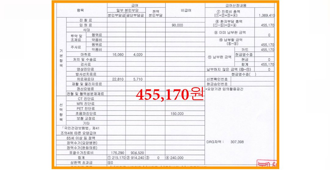 치핵 수술 비용 내역
