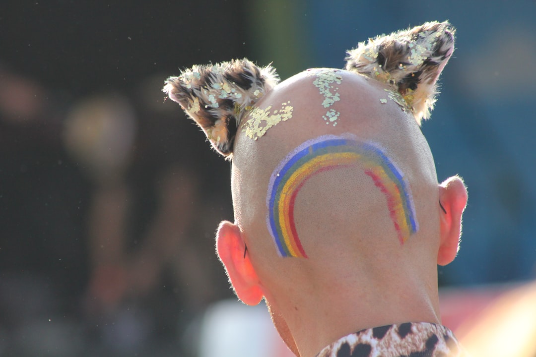 Baldness