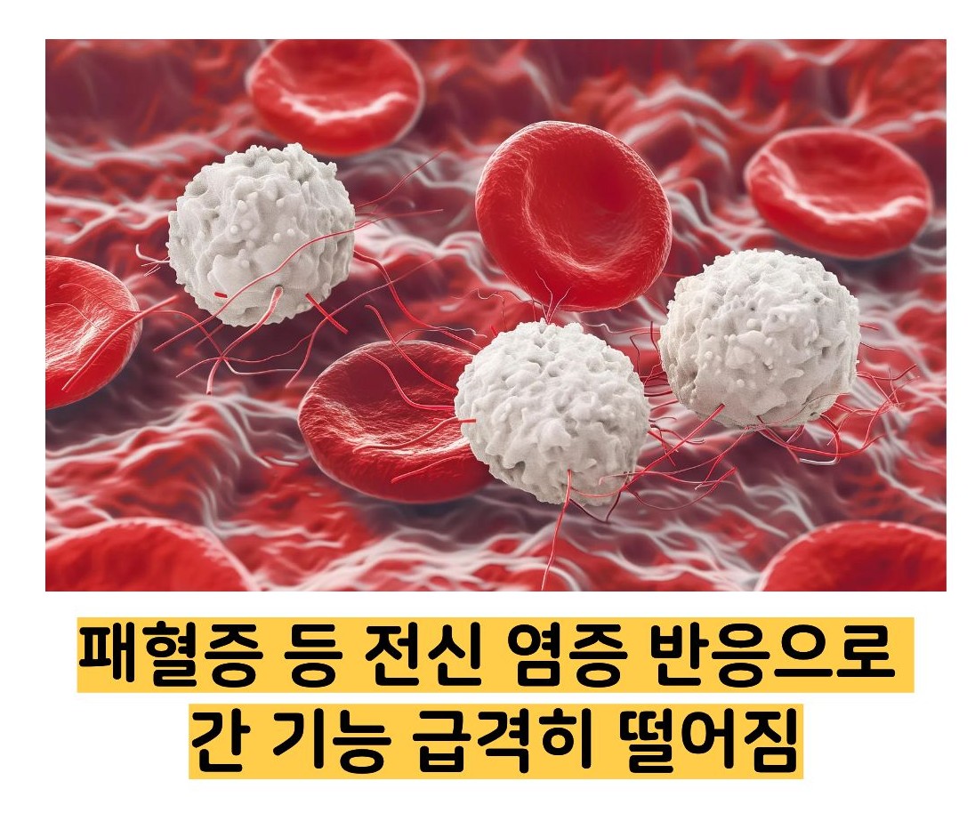 빌리루빈 수치상승 원인