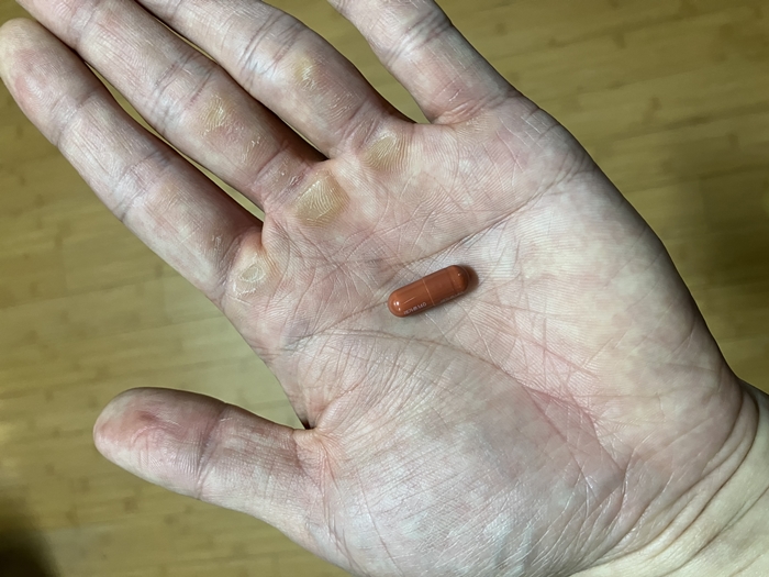 레가론 140 밀크시슬 간 영양제 갈색 캡슐 &ndash; 손바닥 위 실제 크기 비교