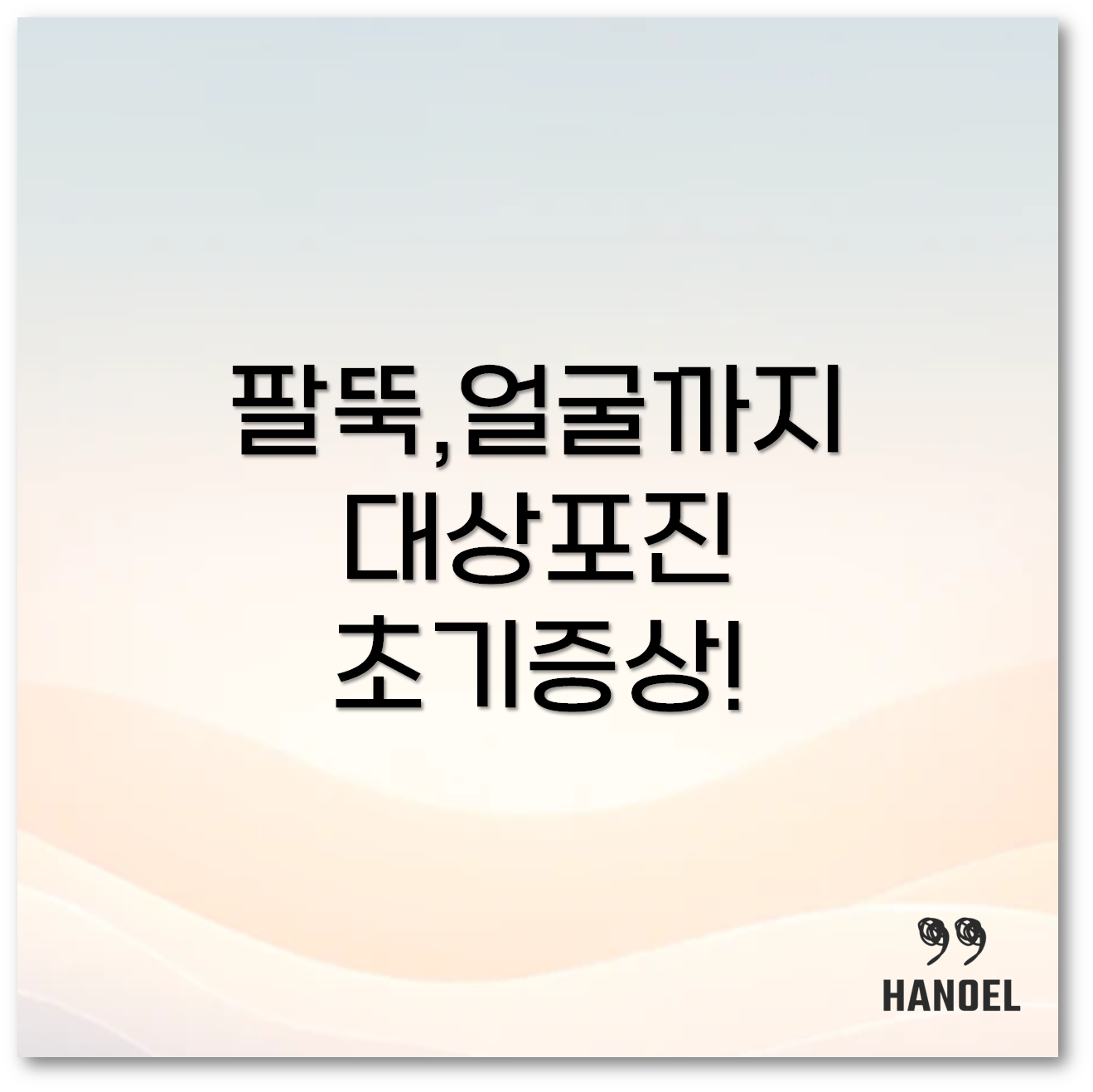 대상포진 초기증상