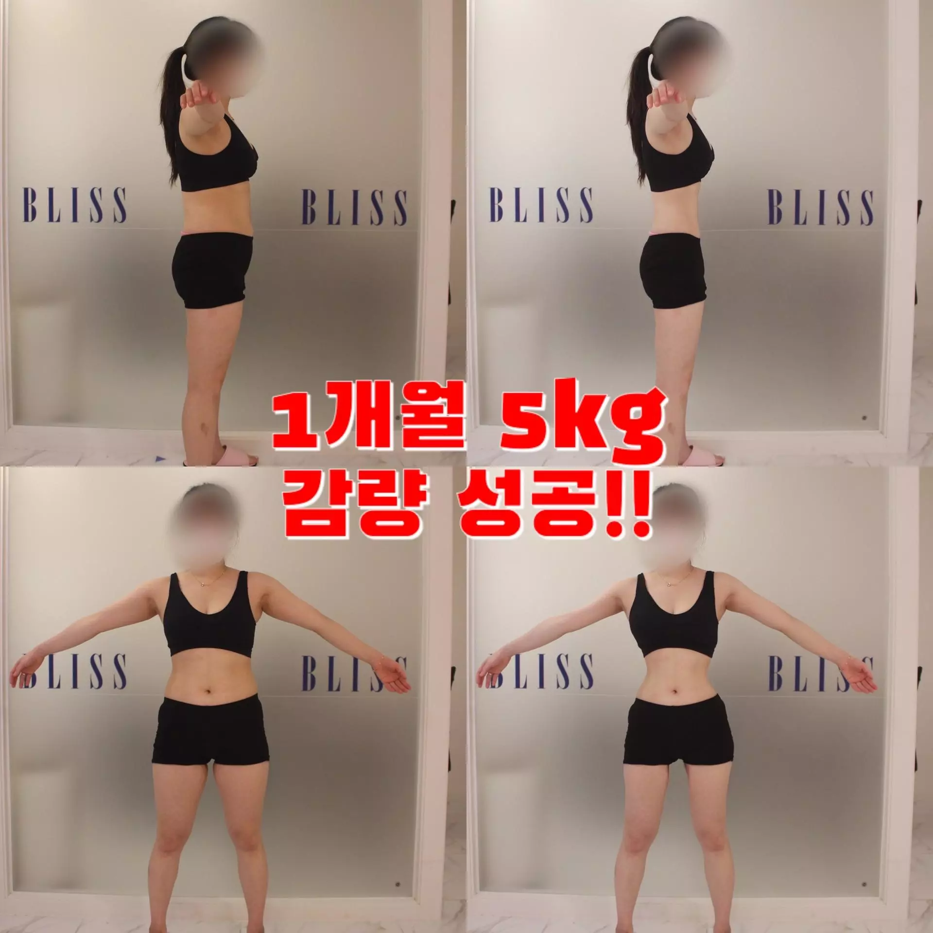 루프밴드 체중 감량