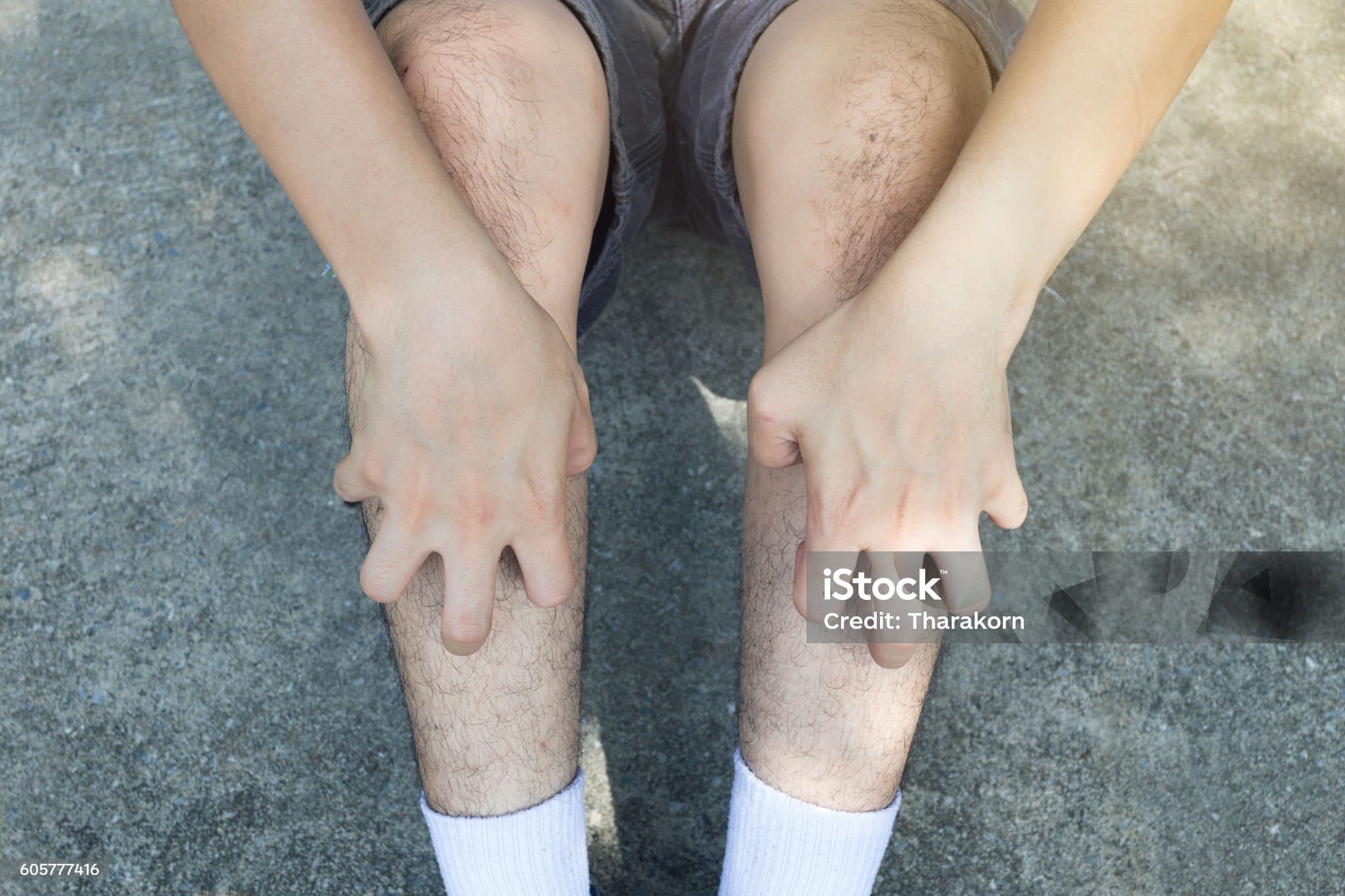 다리가 가려운 이유 무엇일까