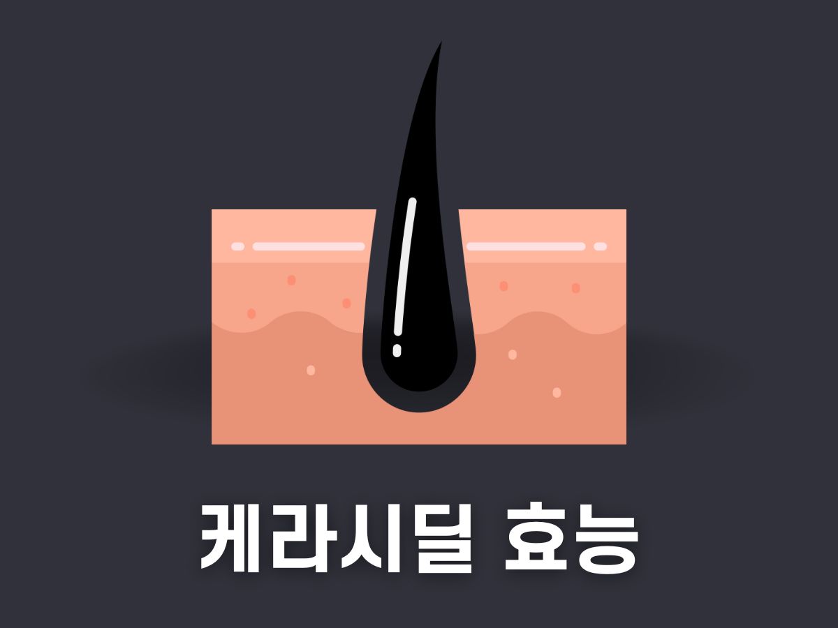 케라시딜 효능