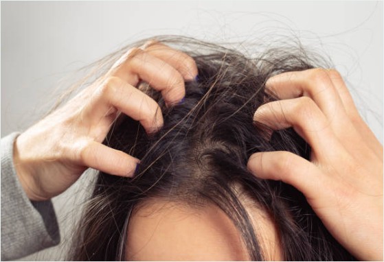 두피 가려움증의 원인