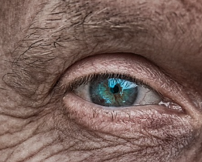 피부암 초기증상 10