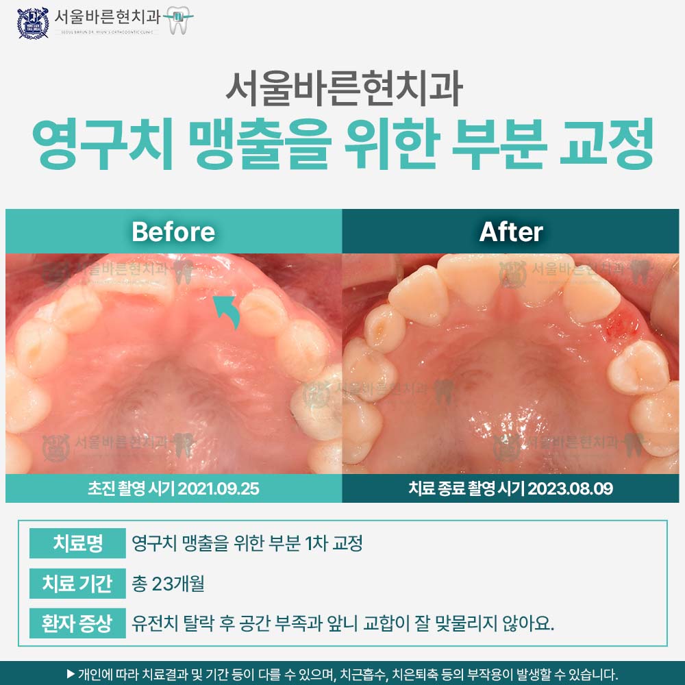 부산교정치과