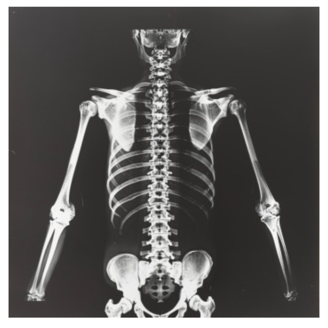 대장암과 관련된 사진입니다.