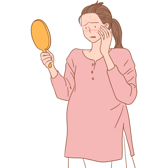 여드름 후유증으로 남은 홍반&amp;#44; 효과적인 관리법은?