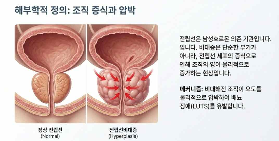 전립선비대증원인-사진10