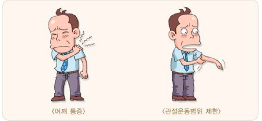 오십견 어깨부위 사진 2